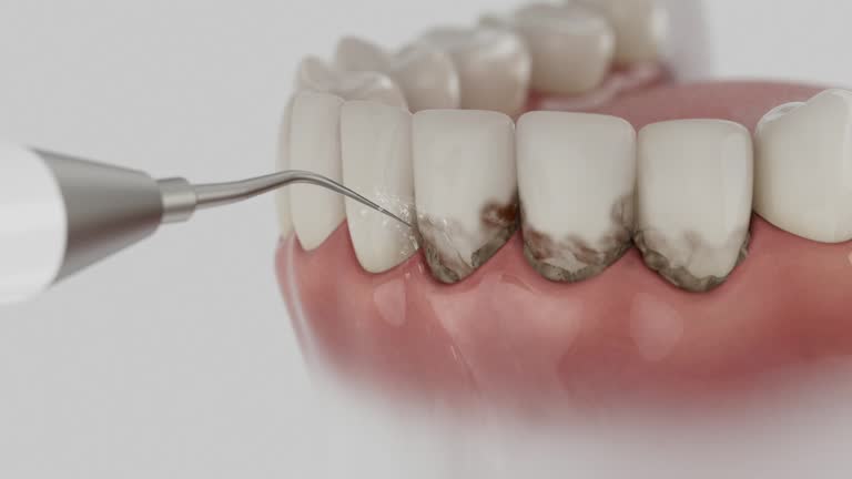 Reliable Tooth Extraction contractor in Oronoco, MN by Smile Center Dentistry